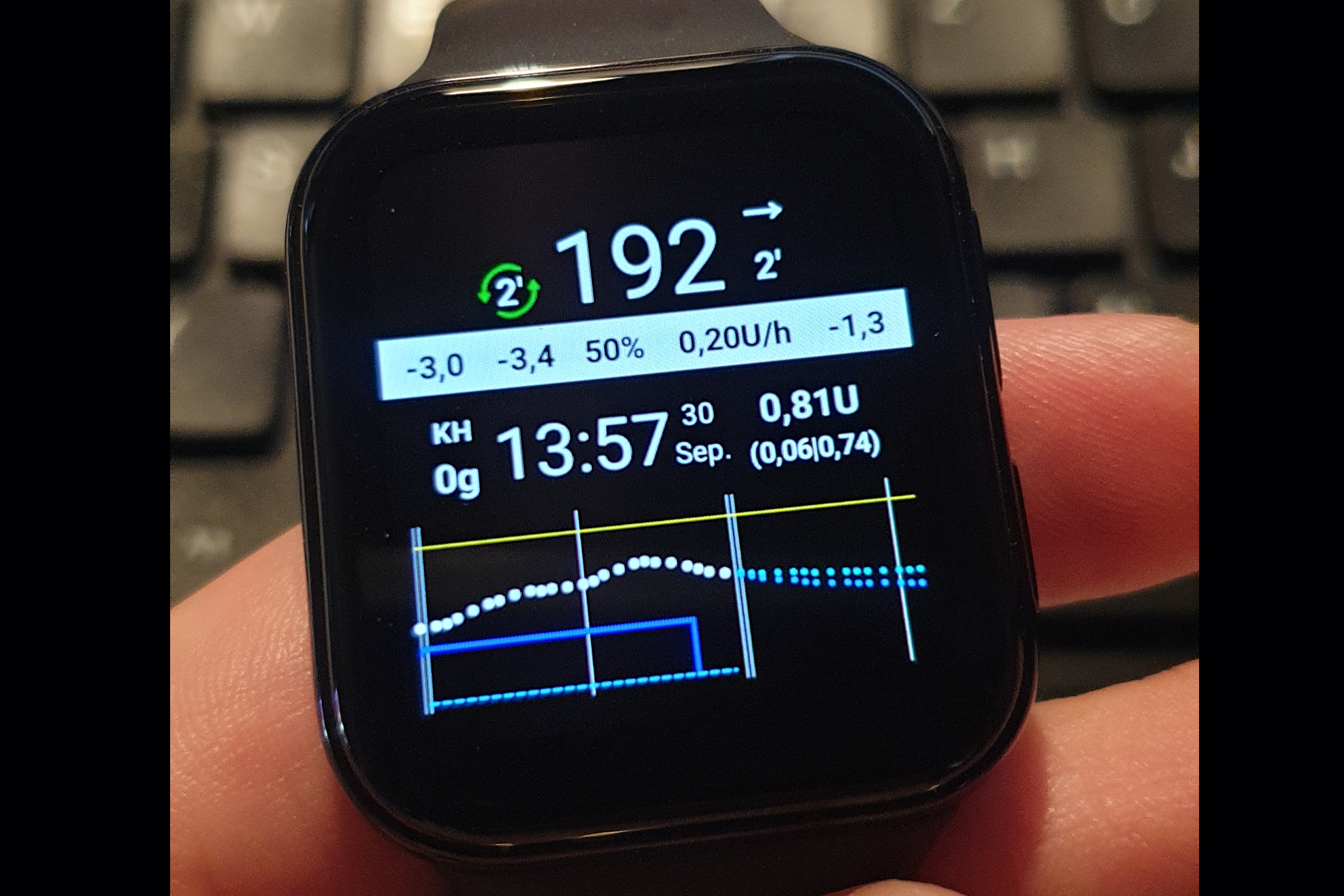 Oppo Watch / Wear OS-Smartwatch mit AAPS und Xdrip+ betreiben