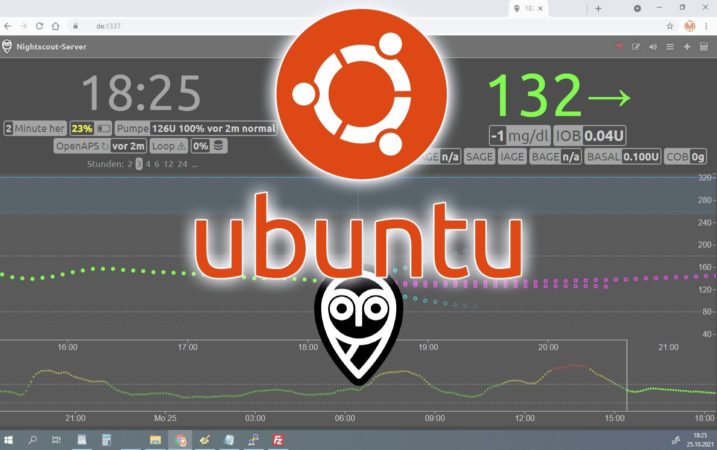 Nightscout Installation auf Ubuntu 20.04 – 1blu VPS